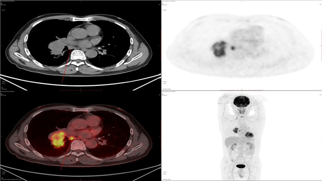 「查癌神器」深圳開(kāi)機(jī) 15分鐘即出結(jié)果