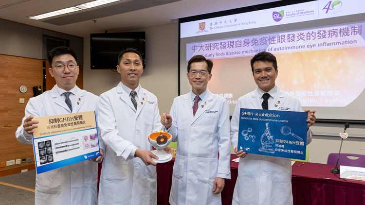 中大研究發(fā)現(xiàn)自身免疫性眼發(fā)炎發(fā)病機制