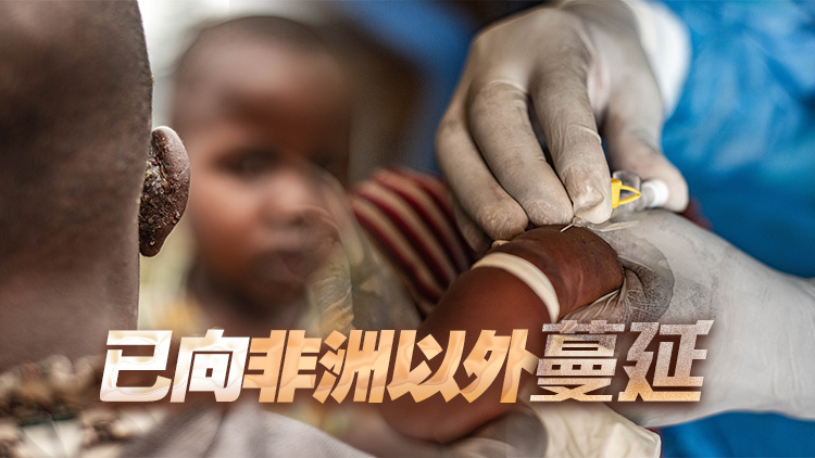 這次猴痘疫情，為什麼如此令人擔(dān)憂？