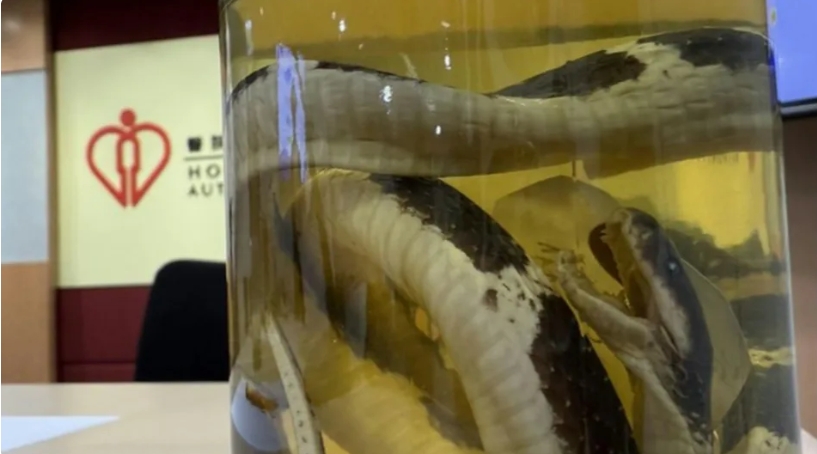 少年網(wǎng)購內(nèi)地毒蛇被咬險喪命 換血5次才獲救